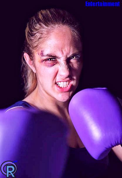 Fastest Way To Get Rid Of A Black Eye